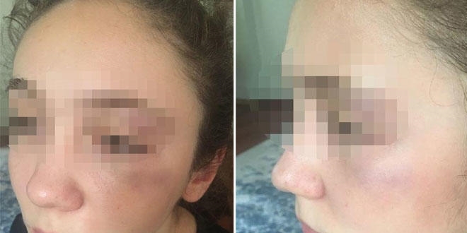 'Antrenör'ün, 14 yaşındaki milli karateciyi dövdüğü' iddiası
