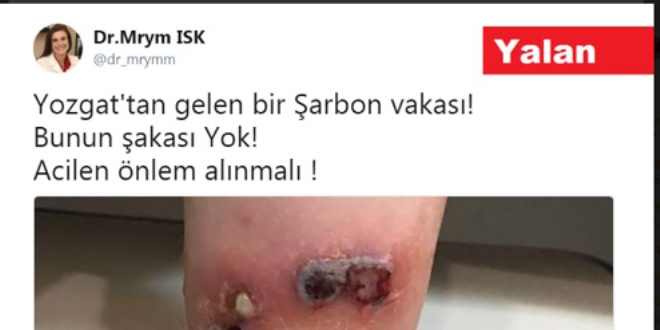 Yozgat'ta şarbon hastası diye servis edilen görsel yalan çıktı