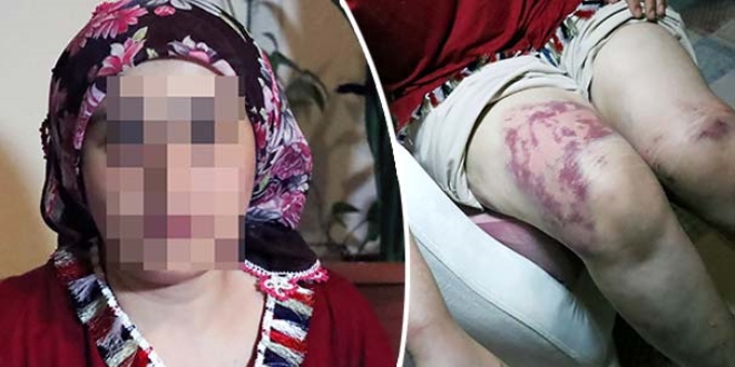 Genç kadından '9 saat işkence' iddiası
