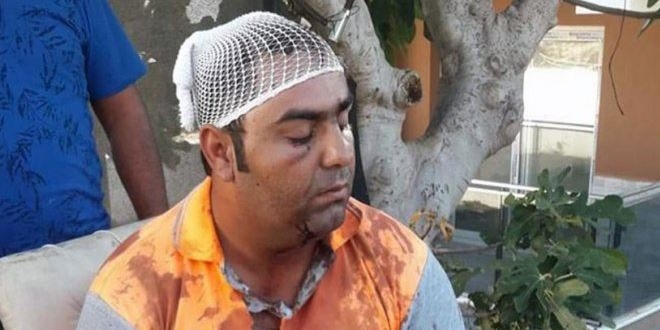Zabıta amirinin temizlik işçisini darp ettiği iddiası