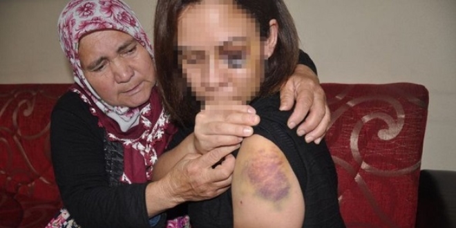 Boşanma davası açtı, koruma karar aldırdı yine de şiddetten kurtulamadı
