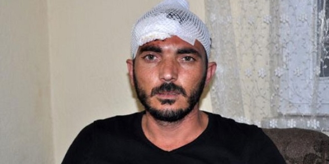 Polisler tarafından dövüldü, ters kelepçe takıldı