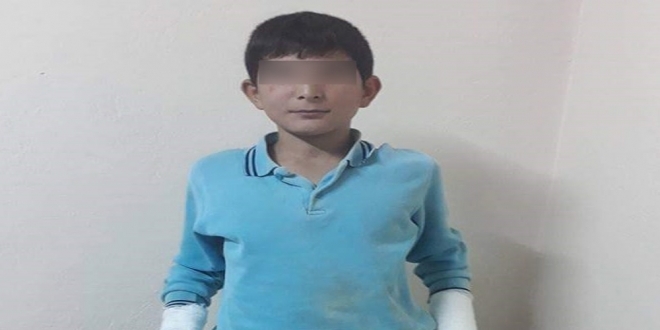 Müdürün öğrencinin parmaklarını kırdığı iddiası