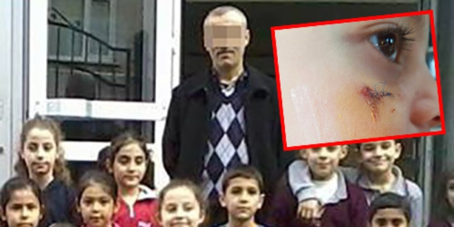 Kitapla darp edilen öğrencinin yüzünde iz oluştu