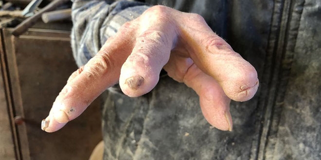 72 yıldır yaptığı işi, ellerini bu hale getirdi!