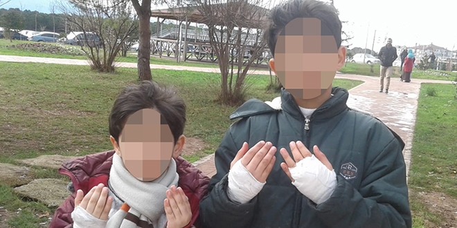 Babanın çocuklarının elini sobada yaktığı iddiası