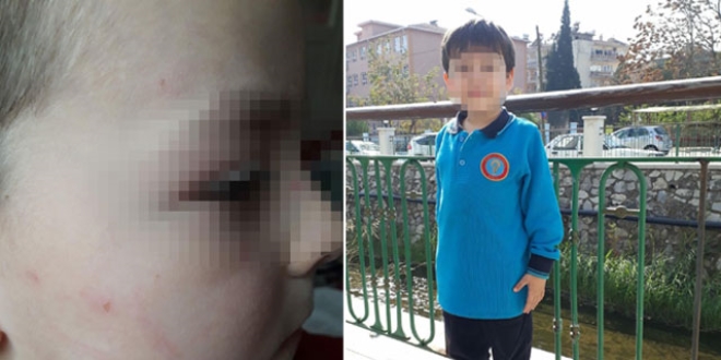 İlkokul öğrencisi okulda dövüldü, anne şikayetçi oldu