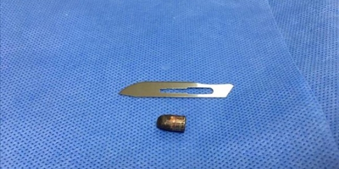 Sarhoş sanılan kişinin kafasındaki mermi çıkarıldı