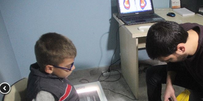 24 parmaklı çocuğa devletten özel ayakkabı