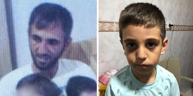Cani babanın korkunç ifadesi: Merdivenden düştü dedim