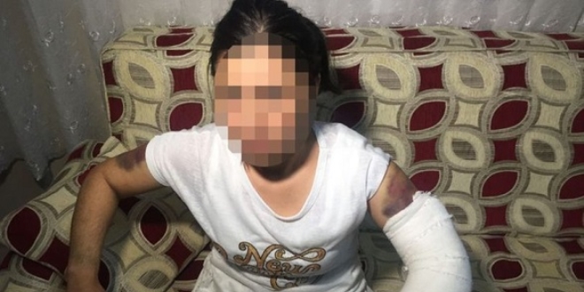 Kocası inşaat demiriyle döverek bu hale getirdi
