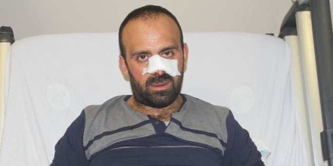 Köpekler saldırdı, burnunu ve bacağını parçaladı