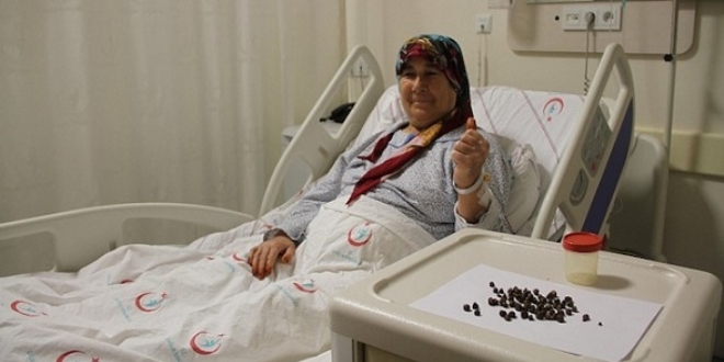 17 yıldır ağrı çekiyordu: 86 parça taş çıktı