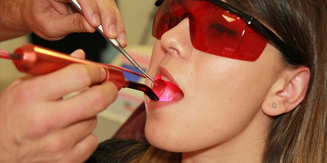 Diş tedavisinde 'düşük seviyeli lazer' dönemi