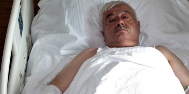 Böbreklerinde unutulan stent 7 yıl sonra fark edildi