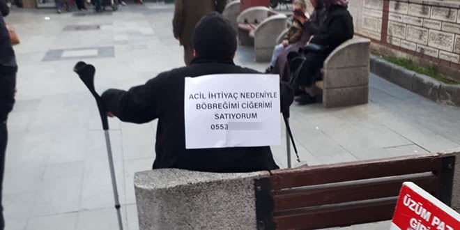 Geçen yıl böbreğini satılığa çıkardı, bu kez ciğerini