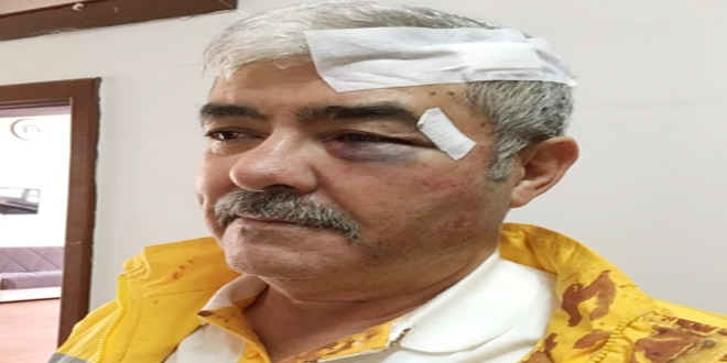 Ambulans şoförünün darbedildiği iddiası