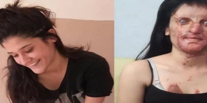 'Bu yüz benim yüzüm değil, toplumun yüzü'