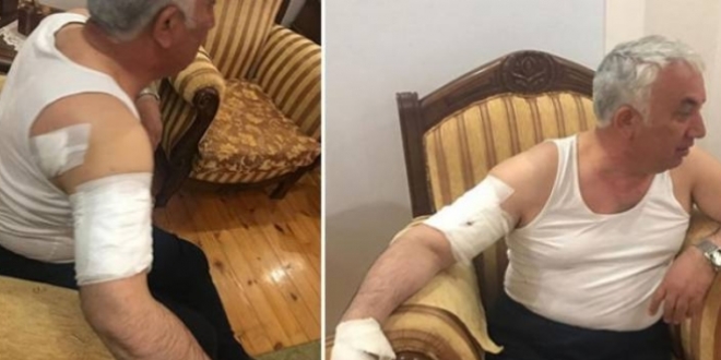 Belediye Başkanı, köpek saldırısında yaralandı