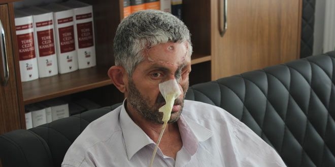 Dişini çektirdi, yüzü bu hale geldi!