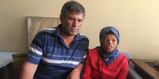 Leyla'nın tek isteği yeni bir yüze kavuşmak