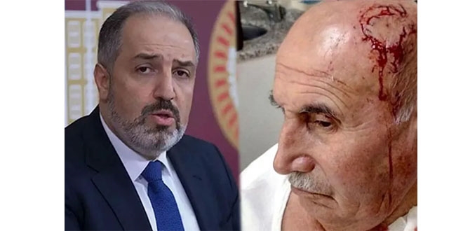 AK Partili vekilden saldırıya uğrayan amca için Kürtçe mesaj