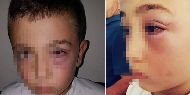 9 yaşındaki çocuğu bu hale getirdi! Gözaltına alındı