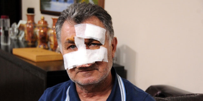 Öğretmenin komşusunun burnunu kırdığı iddiası