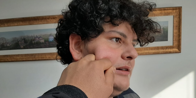 Yanaktan 'makas almak' tazminat sebebi