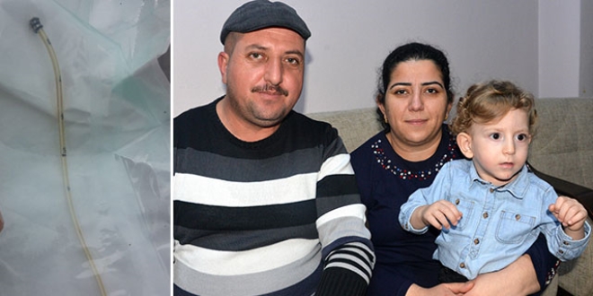 Bebeğin göbeğinde 10 santimlik kateter unutulmuş