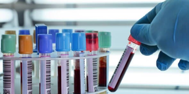 Doktorlara, D vitamini tetkiki kısıtlaması getirildi
