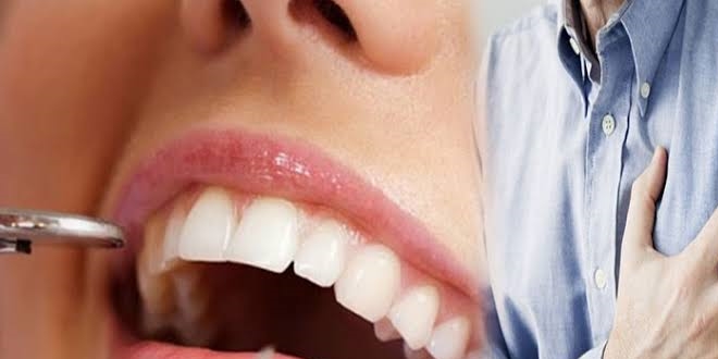Diş çürükleri kalp hastalıklarını tetikleyebiliyor