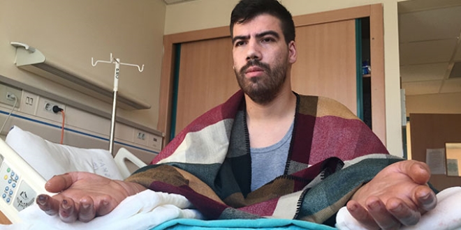 Çift kol nakilli Yusuf'un tırnakları uzamaya başladı