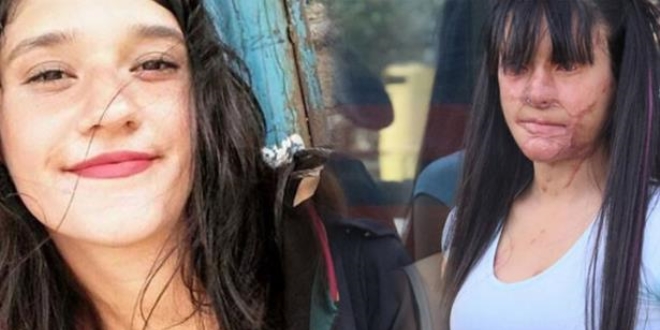 Bakan Selçuk'tan Berfin'in yüzüne asit döken sanığa verilen cezaya tepki