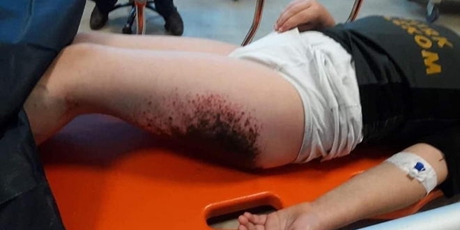 Akıl almaz bir şekilde yanmışlardı, patolojik örnek alınmamış