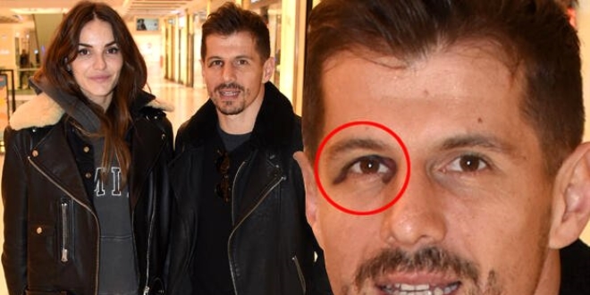 Emre Belözoğlu'nun görüntüsü şaşırttı: Dayak yedim