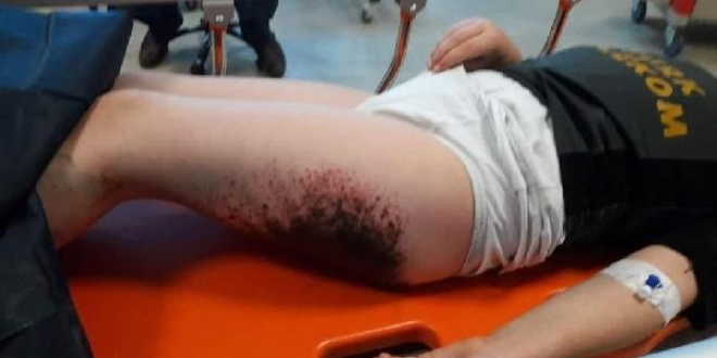 Karla oynayan öğrencilerde görülen lekeler kimyasal değilmiş