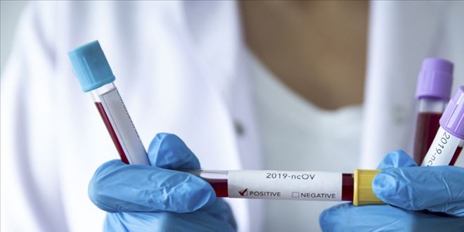 Çin'de Kovid-19 salgınında ölenlerin sayısı 2 bin 120'ye çıktı