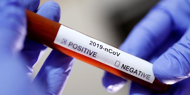 Ankara niversitesi'nde koronavirs testlerine baland