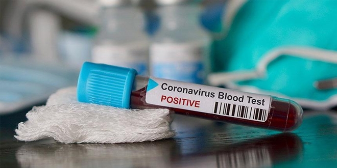 Ülkelerin yaptığı Koronavirüs test sayıları