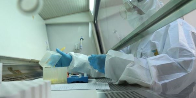 Ankara Üniversitesi tanı kiti projesi için kolları sıvadı