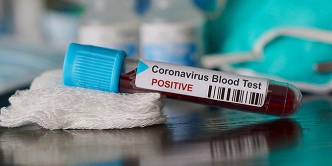 Çocuk hastalıkları doktoru koronavirüse yakalandı