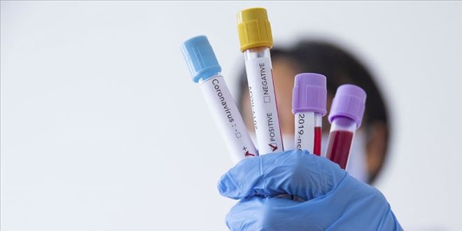 Başhekim'in koronavirüs testi pozitif çıktı