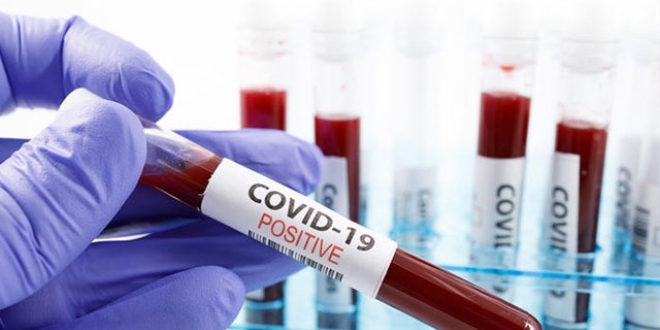 talyan bilim insanlarndan kritik koronavirs raporu