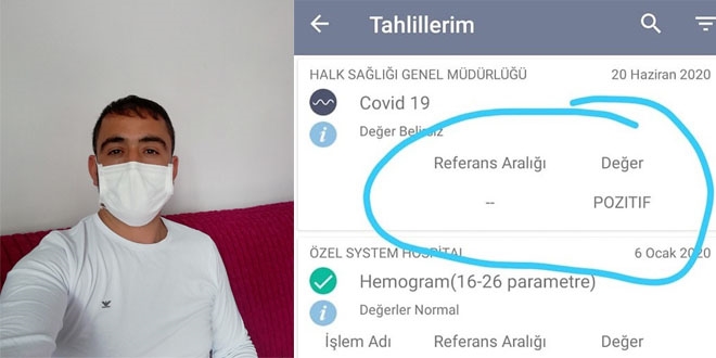 Testi pozitif çıktı sosyal medyadan uyardı