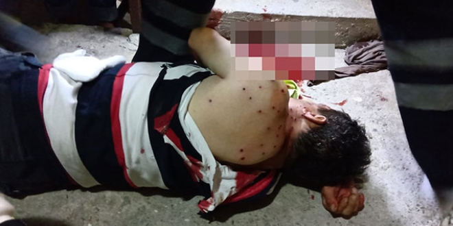 Antalya'da 'da gürültü dehşeti: 1'i çocuk, 3 yaralı