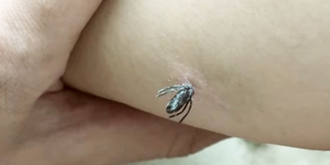 Kene tehlikesine karşı açık renk kıyafet önerisi