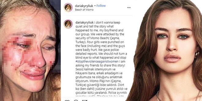 Dünyaca ünlü model Çeşme'de dayak yedi