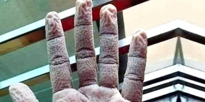 Çapa'da görevli doktorun elinin görüntüsü gündem oldu