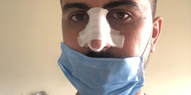 Hasta yakını, sosyal mesafe uyarısı yapan hemşirenin burnunu kırdı